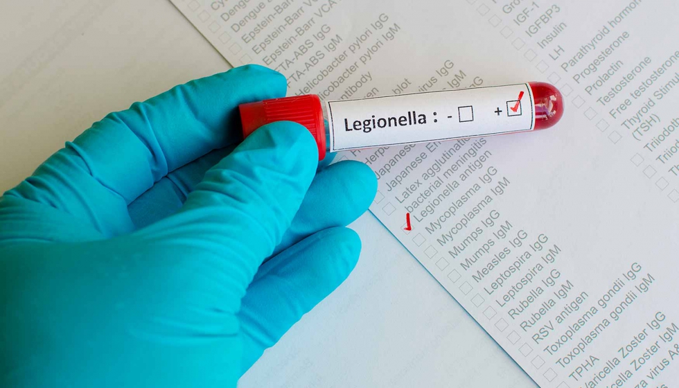 Legionella